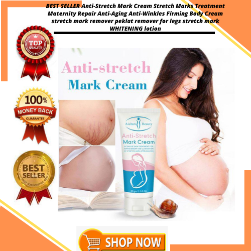 BEST SELLER AntiStretch Mark Cream Stretch Marks Treatment Maternity