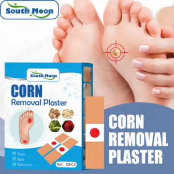 Callus Removal Singapore  Foot Corn Removal Singapore