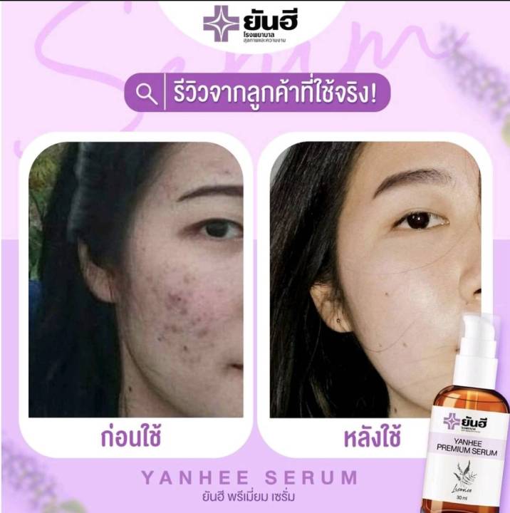 yanhee-serum-ยันฮีพรีเมี่ยมเซรั่ม-yanhee-premium-serum-ยันฮีเซรั่ม-เซรั่มสูตรเฉพาะโรงบาลยันฮี-เซรั่มยันฮี-3-ขวด-ขนาด-30ml