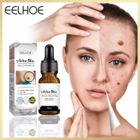 EELHOE Aclive Skin Mole Removal Essence Skin Tag Remover Mole &amp; Genital Wart Removal Antibacterial Liquid Painless Mole Skin Dark Spot Remover Serum Face Wart Tag Removal Solution