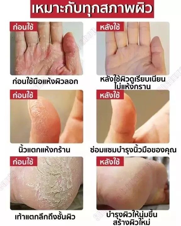 ครีมทามือแตก-ยาทามือแห้งแตก-แฮนด์ครีม-ครีมทามือน้ำมันม้า-ครีมทามือลอก-ช่วยแก้ไขปัญหาผิวหนัง-แห้งหร้าน-ผิวลอก-บำรุงผิวมือ-hand-cream