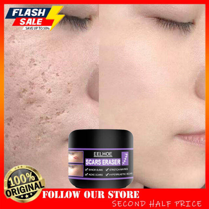 【COD Scar And Acne Mark Removal Gel Ointment Scar Removal Cream Scar