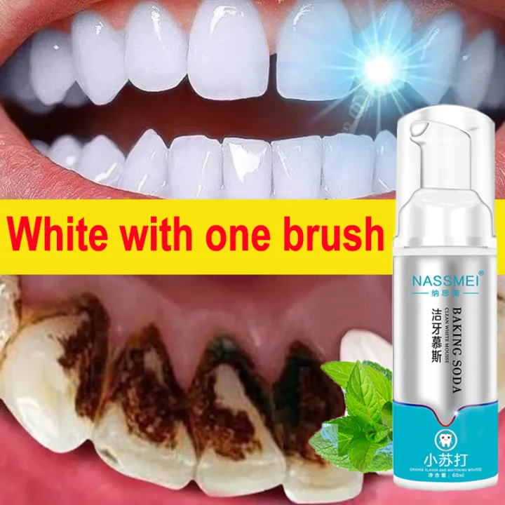 NASSMEI Teeth Cleaning Mousse 60g Teeth Whitening ,White Teeth Oral