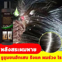 【ส่งจากกรุงเทพ】EELHOE 100ml ขจัดรังแค หยุดอาการคัน ควบคุมน้ำมัน (แชมพูขจัดรังแค ขจัดรังแค แชมพูสมุนไพรยาสระผม ยาสระผมรังแค ยาสระผมขจัดรังแค ดูแลหนังศีรษะ ยาสระผม บำรุงรากผม)