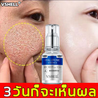 เซรั่มไฮยาบี5 ไฮยาลูรอน HYA สุดคุ้ม สูตรเข้มข้นจากเกาหลี Horec Hydra B5 Essence ผิวชุ่มชื้น เรียบเนียน แลดูอ่อนเยาว์ กระจ่างใส