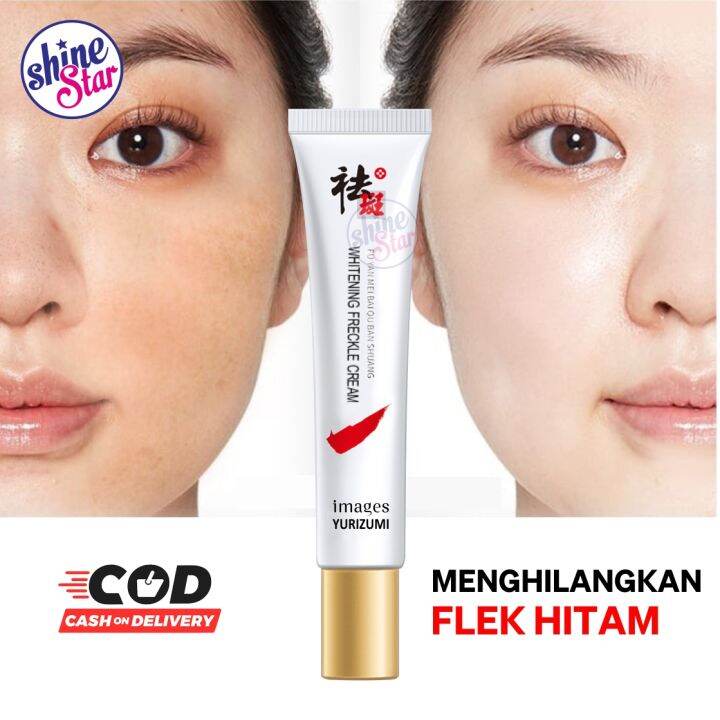 Krim Penghilang Flek Hitam Melasma Bintik Jerawat Yurizumi Whitening ...