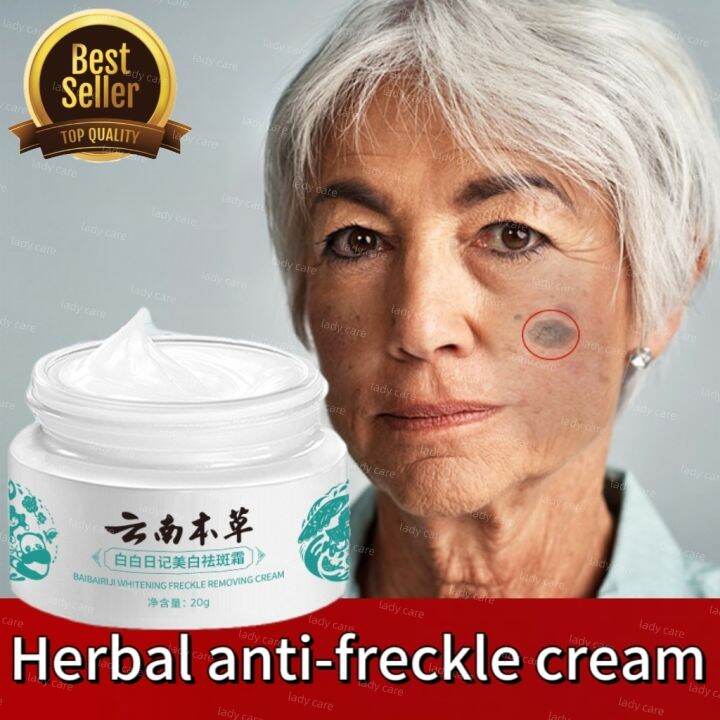 Japanese Melasma Cream Yunnan Herbal Whitening Freckle Cream Japanese