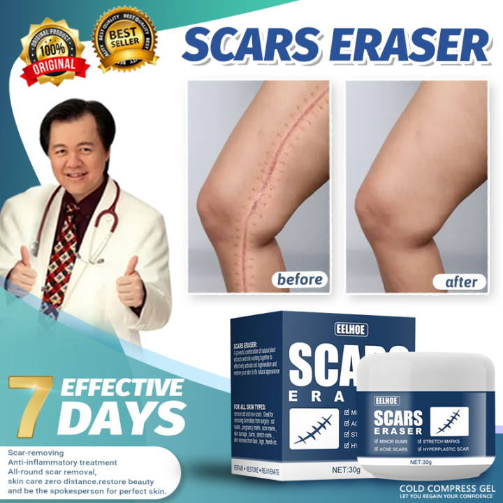 scars remover for old scars fix scar removal original scar remover gel