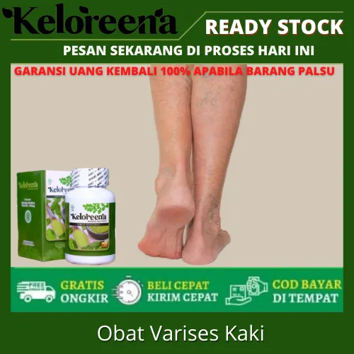 Obat Varises Kaki Obat Penghilang Varises Di Kaki Obat Varises Di