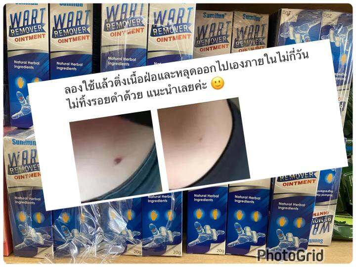 พร้อมส่งส่งฟรี-ครีมทาหูดไฝติ่งเนื่อ-บำรุงผิว-ขนาด-20-กรัม