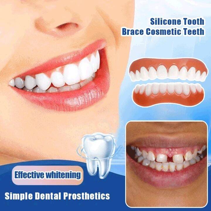 【Ready stock】 Silicone Tooth Brace Cosmetic Teeth artificial braces ...