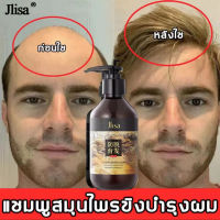 ลดกระหน่ำ ? ZHENXIU แชมพูแก้ผมร่วง ยาสระผมเร่งยาว ยาสระผมแก้ร่วง 300ml สูตรน้ำขิง ปลูกผมอย่างอ่อนโยน บำรุงรากผม（แชมพูปลูกผมดก แชมพูสระผม