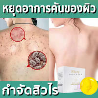 สบู่ลดสิวหน้า สบู่หน้าขาวใส สบู่กำจัดไรสิว ไวท์เทนนิ่ง  ทำความสะอาดผิว ให้ความชุ่มชื่น เหมาะสำหรับผิวที่มีปัญหาสิว ใช้ได้ทั้งตัว หน้า บนหลัง 100g