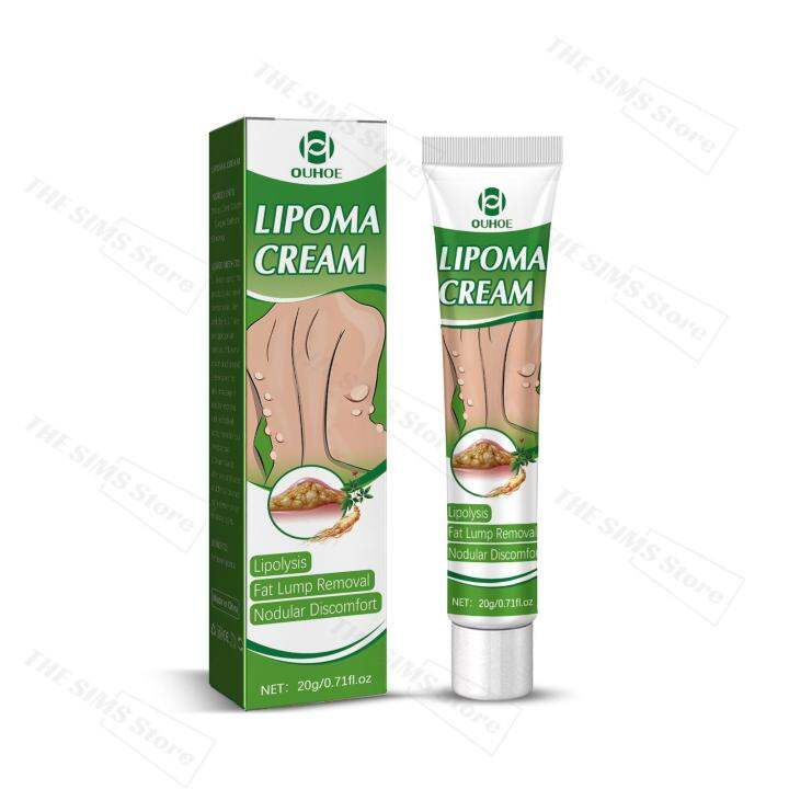 7 days to quickly eliminate 🥇lipoma removal cream 30g Fat Lump Removal ...