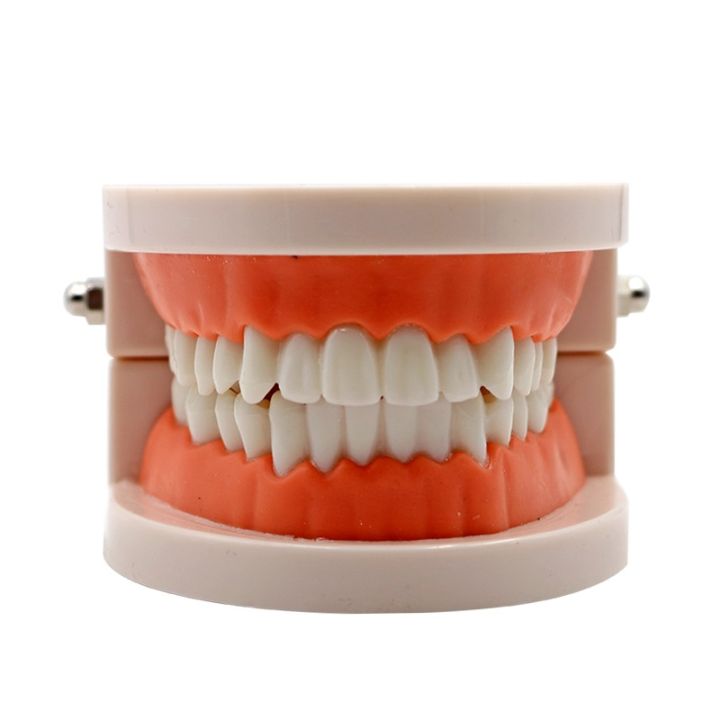Mô hình hàm dưới và bệnh lý của răng