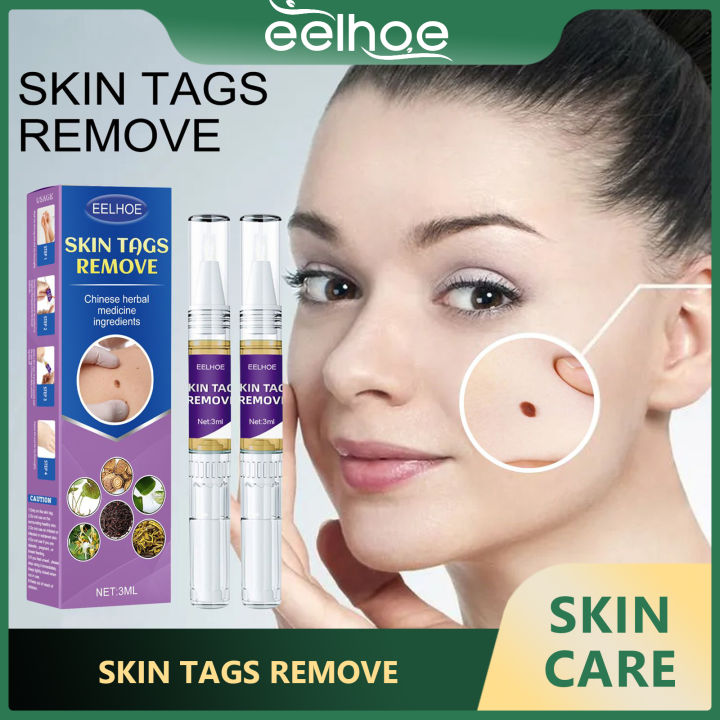 Eelhoe Skin Tags Revmove Anti Wart Liquid for Removing Body Skin ...