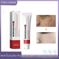 Spot removal cream ครีมทาผิวกระ กระ ครีมไวท์เทนนิ่ง ครีมทาหน้าขาว ครีมลดฝ้า ครีมลดฝ้า ครีมทาฝ้าหนาๆ ครีมแก้ฝ้า ครีมรักษาฝ้า ครีมทาฝ้า โครีมทาฝ้ากระ ครีมทาฝ้ากระ ครีมลบฝ้า ครีมแก้ฝ้าแท้ๆ ครีมแก้ฝ้ากระ ป้องกันริ้วรอย ดูกระจ่างผิวใส ทาฝ้าหนาลึก