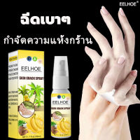 [EELHOE สเปรย์ฉีดเท้า 50ml]ครีมทาเท้าขาว ทาเท้าคัน ครีมทามือ ครีมนวดเท้า บรรเทาอาการคัน ผิวเท้านุ่มเนียน  ครีมทาเท้าแตก ครีมทาส้นแตก ครีมส้นเท้า ครีมทาส้นเท้า ครีมดูแลเท้า ครีมบำรุงเท้า ดูแลมือ โลชั่นทาเท้า ครีมส้นเท้าแตก สเปรย์ฉีดดูแลเท้า สเปรย์บำรุงเท้า