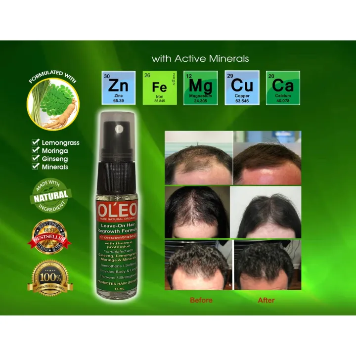 OL'EO Leave-On Spray Hair Regrowth with Minerals SPF 30T9m | Lazada PH OL'EO Leave-On Spray Hair Regrowth with Minerals SPF 30T9m | Lazada PH