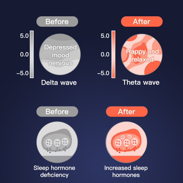 ces-sleep-aid-นอนไม่หลับ-electrotpy-อุปกรณ์ความวิตกกังวลและภาวะซึมเศร้าไมเกรนบรรเทาความวิตกกังวลปวดศีรษะ-fast-sleep-instrument