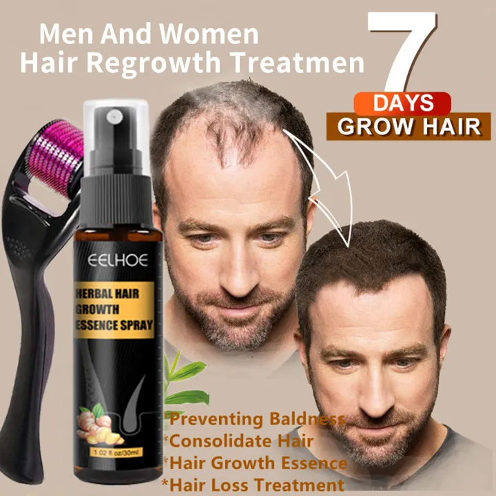 Minoxidil hair grower for men women original hair growth serum 7 days minoxidil regrow hair growth Minoxidil hair grower for men women original hair growth serum 7 days minoxidil regrow hair growth