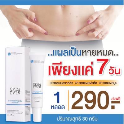 ครีมทาคีลอยด์ 1 ชิ้น 170 บาท 30 กรัม พร้อมส่งในไทย