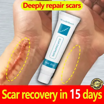 Scar Removal Cream Non-greasy Non-irritating Effective In Removing Stretch  Marks Treatment Repairing | Fruugo SA