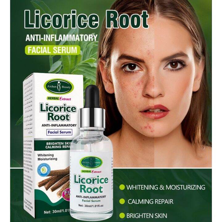 Acne removal Serum 30ml Acne Treatment Plant Extract Essence Licorice