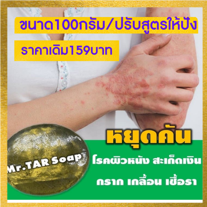 สบู่น้ำมันดินmr-tar-soap-สบู่น้ำมันดิน-100กรัม-สะเก็ดเงิน-เซบเดิร์ม-ผิวหนังอักเสบ-ผื่นคัน-ส่งด่วน