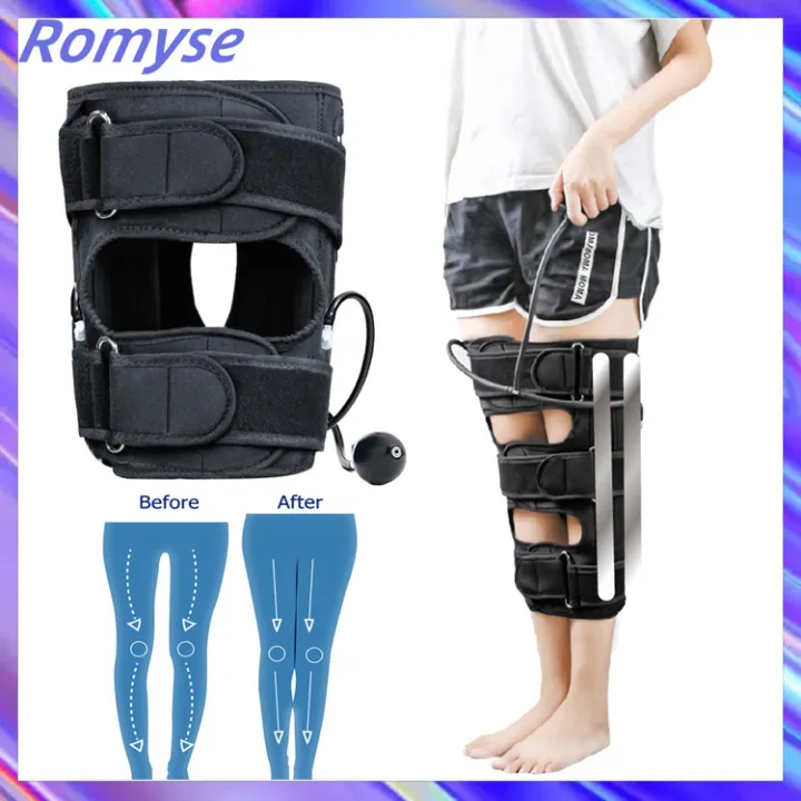 Romyse เข็มขัดแก้ไขขา O/X ที่มีประสิทธิภาพ เข็มขัดเอว ขาโค้ง เข่า ...