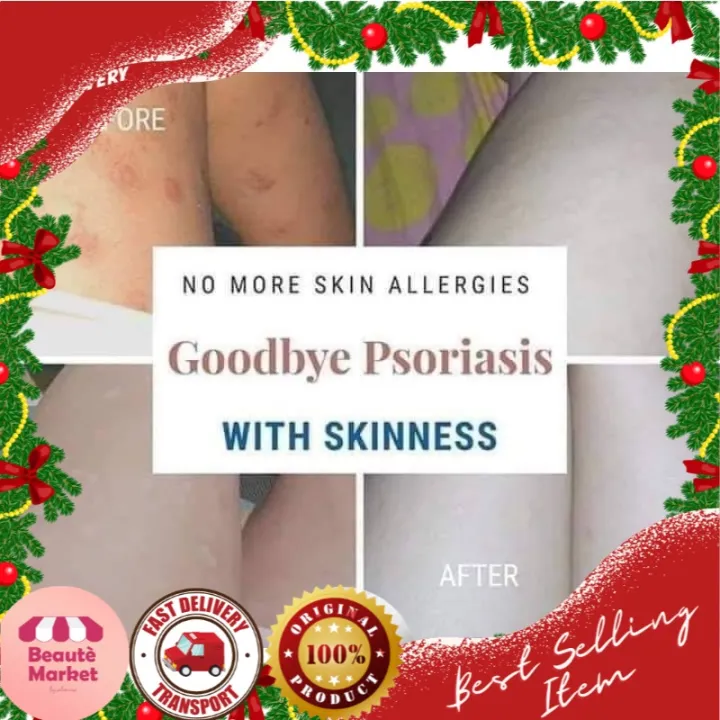 BEST SOAP FOR SKIN PROBLEMS KnowWell Lazada PH