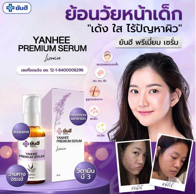 yanhee-premium-serum-เซรั่มยันฮีพรีเมี่ยม-แก้-สิว-ฝ้า-กระ-จุดด่างดำ-เซรั่มสูตรเฉพาะโรงบาลยันฮี-ขนาด-30-ml