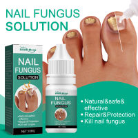 South Moon Nail Care Essence Onychomycosis Brightening Toenail Repair Thickening Yellow Endogenous Inlay