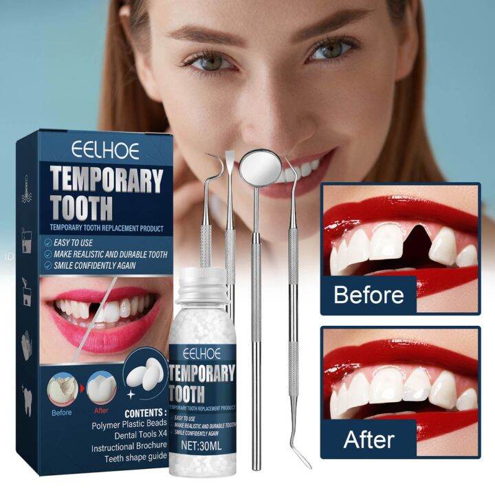 Tooth Filling Glue Set Temporary Tooth Repair Kit False Teeth Solid
