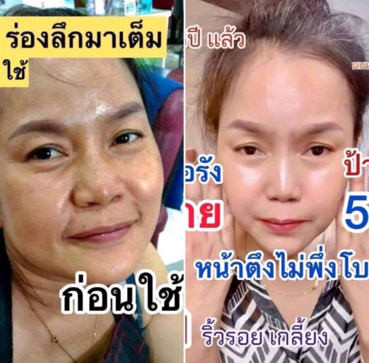 mayaเซรั่ม-mayaโบท็อกซ์-เซรั่มมายา-เซรั่มโบท็อกซ์มายา-เซรั่มโบท็อกซ์maya-เซรั่มโบท็อกซ์-mayaโบท็อก