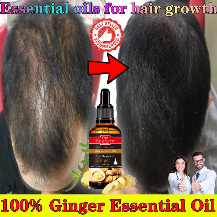 Ginger Hair Growth Essential Oil Hair growth essential oil care Essence Oil  Accelerates hair growth, prevents