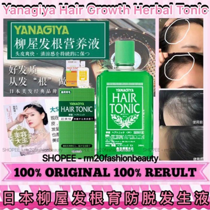 Ready Stock 100 Original Japan Yanagiya Hair Growth Herbal Tonic Hair Loss日本柳屋防脱发生液 Shiseido 2301