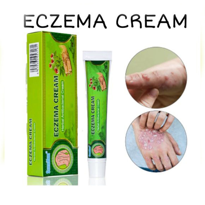 Sumifun Eczema Cream Gamot Sa Kati Kati Sa Balat Ointment for Itchy ...