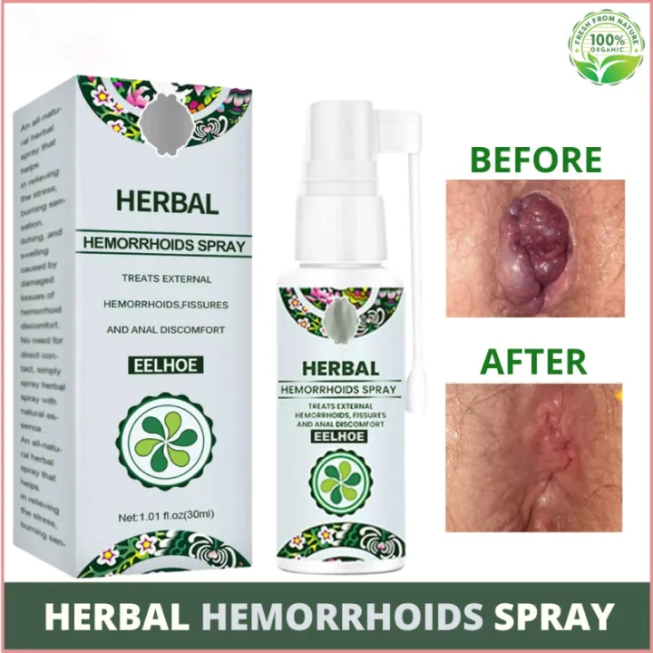 Original Herbal Hemorrhoids Spray Natural Safe And Effective Treatment Of Hemorrhoids Chinese 1126