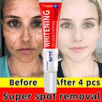 Effective Whitening Freckle Cream Nicotinamide Dark Spots Removal Melanin Melasma Brightening Anti-Acne Moisturizing Skin Care