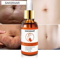 Stretch Marks Remover Essential Oil Skin Care Treatment Cream For Stretch Mark Removal Maternity Slackline For Oils