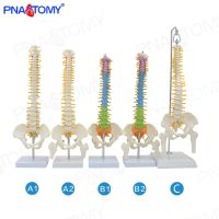 Human spinal dislocation model medical practice bonesetting cervical vertebra bone model lumbar spine bending orthopaedic teaching