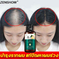 ของแท้ 100% ZENSHOWแชมพูแก้ผมร่วง500mlแชมพูขิงเพียว เร่งผมเกิดใหม่ ผมยาวไว ยับยั้งรังแค แชมพูลดผมร่วง （แซมพูเร่งผมยาว  แชมพูแก้ผมร่วง ผมบาง ปลูกผม น้ำยาเร่งผมยาว ยาปลูกผม /เซรั่มปลูกผม ดูแลผม ป้องกันผมร่วง รักษาผมร่วง เซรั่มบำรุงผม เซรั่มใส่ผม ）