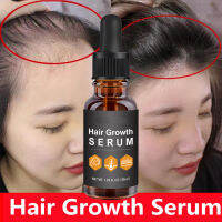 JIU YU Soro De Crescimento Do Cabelo Óleo De Essência De Gengibre Crescedor De Cabelo Rápido Agente De Tratamento De Cabelo Rebrota Eficaz Do Cabelo Cuidado Do Cabelo Óleo Essencial