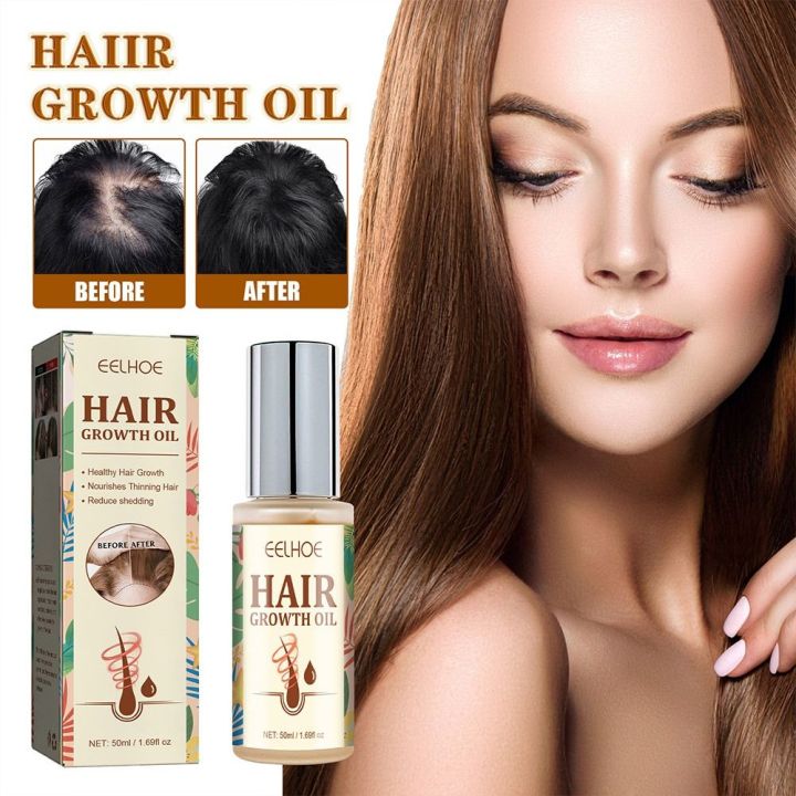 CHUAN Hair Regrowth Oil Germinal Serum Anti Hair Loss Hair Loss Oil ...