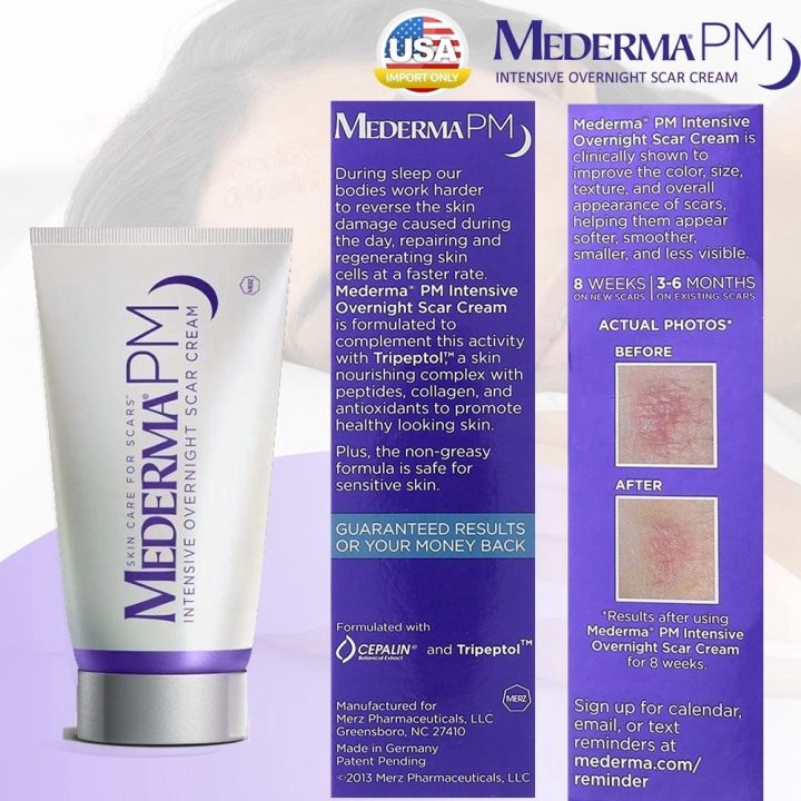 ครีมลดรอยแผลเป็น-mederma-pm-intensive-overnight-scar-cream-1oz-รักษาแผลเป็น-เห็นผลดีที่สุด