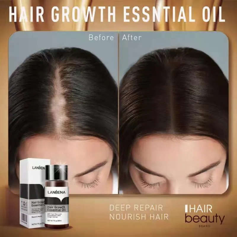 Hair Growth Minoxidil 15% Hair Grower soap for men and women effective beard grower Hair grower biotin balm dr hair plus Hair growth serum essential oils hair treatment original Herbal Nourish Roots Hair Growth Minoxidil 15% Hair Grower soap for men and women effective beard grower Hair grower biotin balm dr hair plus Hair growth serum essential oils hair treatment original Herbal Nourish Roots