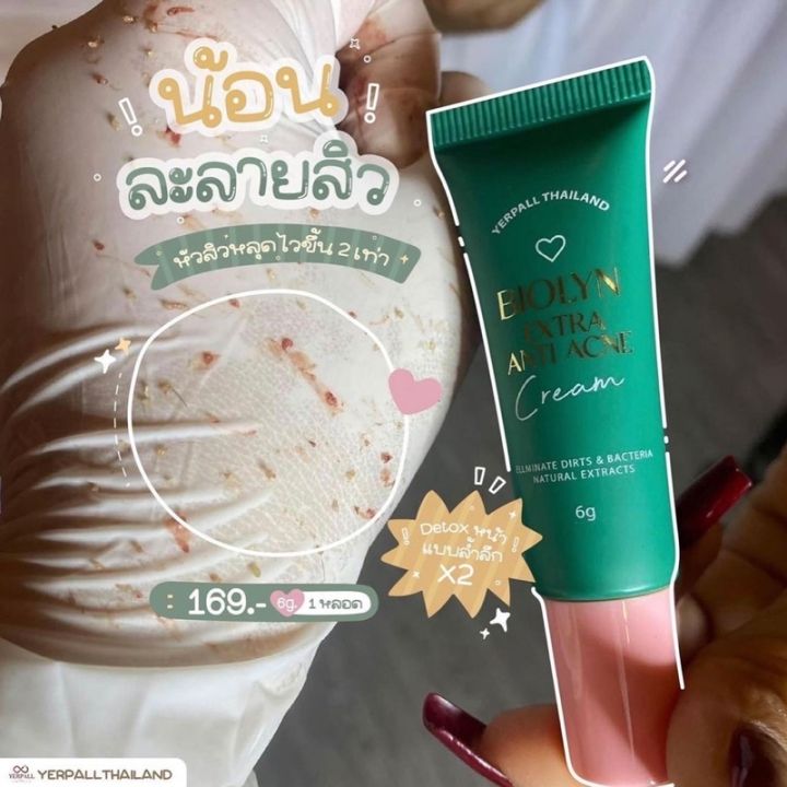 ละลายสิว-1-แถม-1-anti-ance-cream-ลดสิวอุดตัน-สิวเสี้ยน-สูตรใหม่เห็นผลไวขึ้นx2-ดีท๊อกรูขุมขน-ลดเกิดสิว