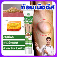 [โปรโมชั่น] OUHOE ออกแบบ36ชนิดของไขมันใต้ผิวหนังกำจัดมวลก้อนไปยังถุงน้ำ Lymph Care Ointment สมุนไพรกำจัด ก้อนเนื้อใต้ผิวหนัง ก้อนซีสต์ ก้อนไขมัน ครีมทาซีส ก้อนไขมัน ครีมระบายน้ำเหลือง ครีมน้ำเหลืองแบบอ่อนโยน ครีมบวมคอ ต่อมน้ำเหลืองบริเวณรักแร้ พร้อมส่งทั