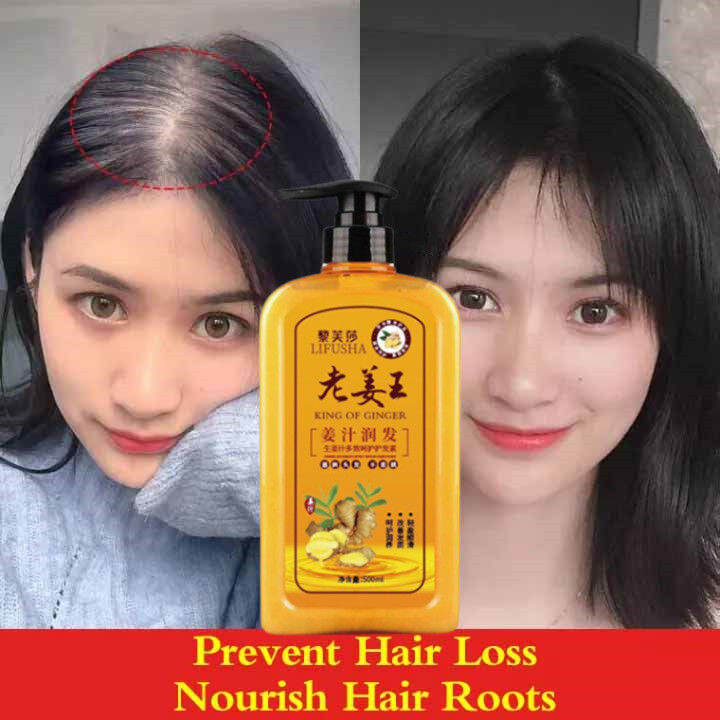 Original Ginger Shampoo Fast Powerful Hair Growth Liquid Anti Hair Loss Shampoo 500ml Lazada Ph 8372